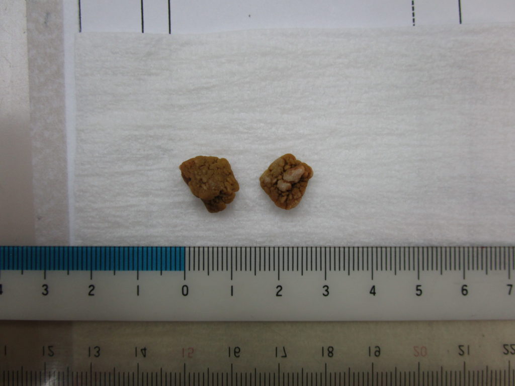犬の膀胱結石の手術（泌尿器外科） やまと動物病院