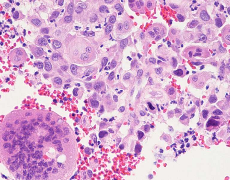 猫の注射部位肉腫と線維肉腫